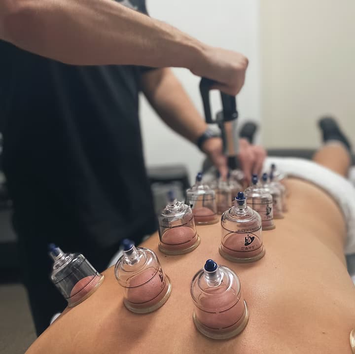 Myotherapy treatment at the Dynamic Therapy Deer Park clinic